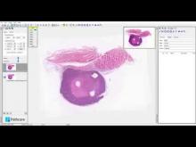 Embedded thumbnail for Registering and overlaying images in Sedeen